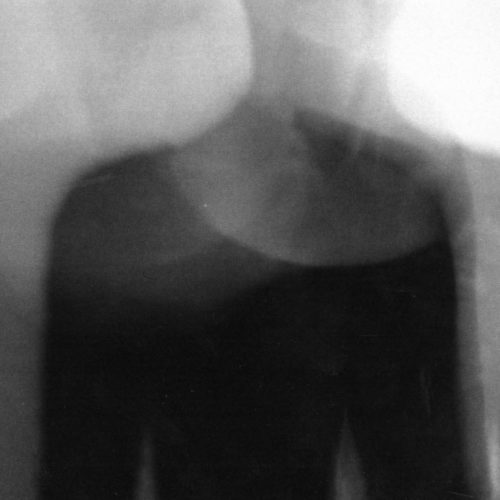 Close up of woman's body with blurred movement in a black and white film photo